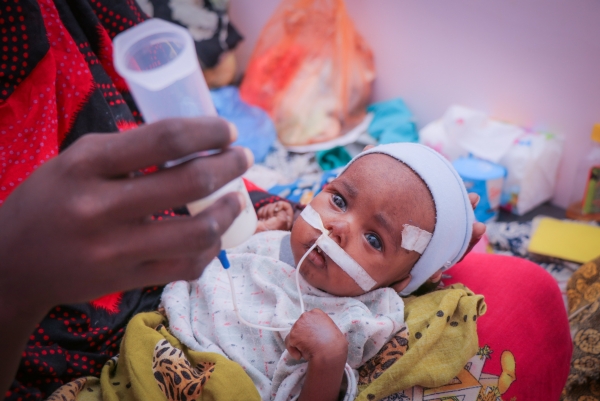 اليونيسف: 2.2 مليون طفل يمني بحاجة إلى علاج من سوء التغذية الحاد